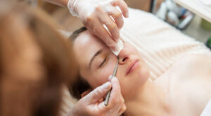 How Long Does Rhinoplasty Recovery Take? Timeline & Tips Explained