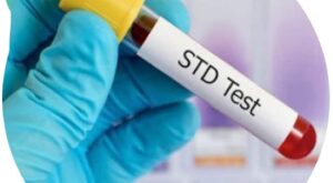 STD Test in Dubai for Men: Symptoms, Risks, and Testing Options