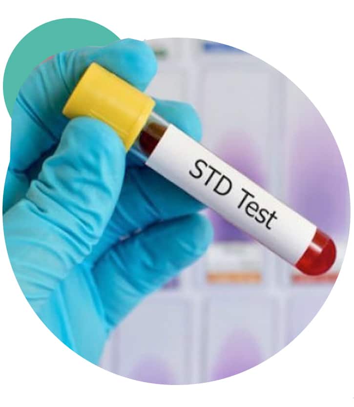 STD Test in Dubai for Men: Symptoms, Risks, and Testing Options