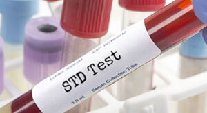 Top 5 Myths About STD Test in Dubai Debunked