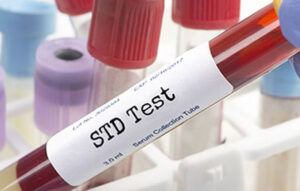 Top 5 Myths About STD Test in Dubai Debunked