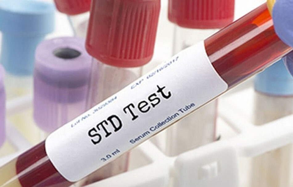 Top 5 Myths About STD Test in Dubai Debunked