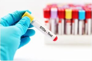 The Most Reliable Labs for STD Test in Dubai: Expert Recommendations