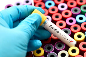 STD Test in Dubai: Affordable Screening for All Major STDs