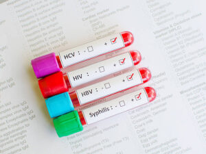 STD Test in Dubai: Confidential Services for Everyone