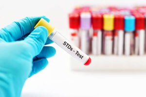 STD Test in Dubai: Quick, Private, and Reliable Services