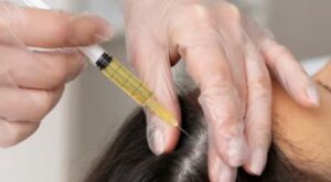 Why Many Are Choosing Eyebrow Hair Transplant: A Smart Move for Natural Brows