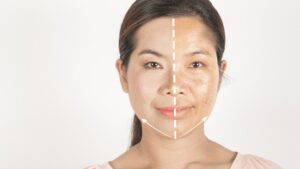 Innovations Transforming Skin Pigmentation Treatment in Riyadh
