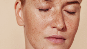 How to Choose the Right Products for Dermal Pigmentation in Riyadh