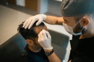 Stem Cell Hair Transplant: Unlocking the Potential of Your Hair Follicles