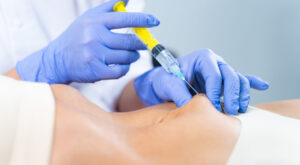 Fat Melting Injections vs CoolSculpting: What to Choose