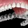 teeth aligners perth