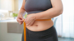 The Impact of Weight Fluctuations on Tummy Tuck Outcomes