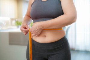 The Impact of Weight Fluctuations on Tummy Tuck Outcomes
