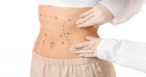 Tummy Tuck Surgery in Dubai: Benefits and Potential Risks