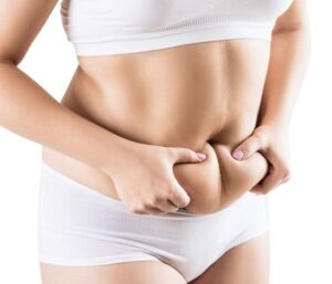 Tummy Tuck in Dubai: Everything You Need to Know About Scarring and Healing