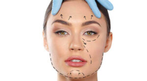 What Are the Most Common Complications After a Facelift?