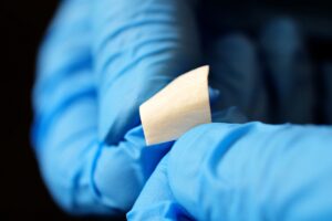 How Amniotic Grafts and Membrane Allografts Are Revolutionizing Regenerative Medicine