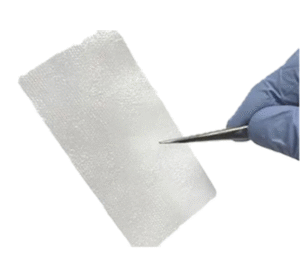 Selecting the Right Amniotic Wound Care Products for Chronic and Acute Wounds