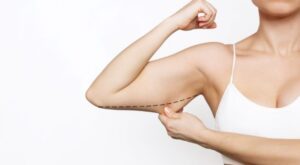 Your Path to Slimmer Arms Begins with an Arm Lift