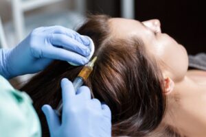 Is the Best PRP Hair Treatment Right for You? Find Out Here