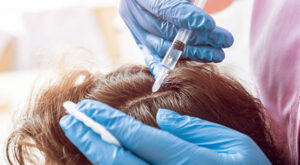 How the Best PRP Hair Treatment Helps with Hair Regrowth