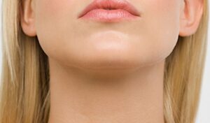 Double Chin Removal Solutions That Deliver Visible Results