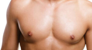 Gynecomastia Diagnosis: What to Expect During Your Evaluation