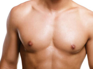 Gynecomastia Diagnosis: What to Expect During Your Evaluation