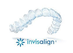 What to Expect During Your First Invisalign Appointment: Expert Insights for New Patients