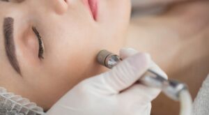 Is Hydrafacial Good for Acne? Real Results for Fresh, Healthy Skin