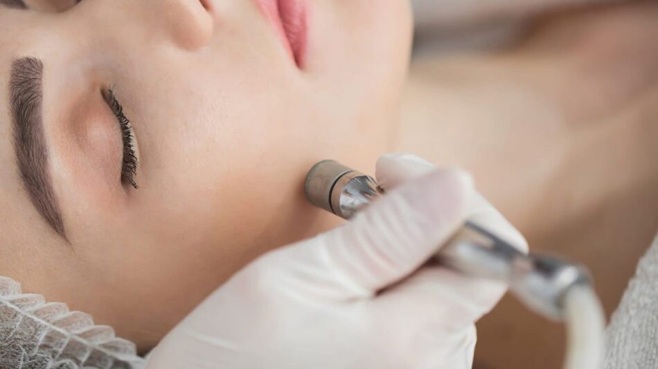 Is Hydrafacial Good for Acne? Real Results for Fresh, Healthy Skin