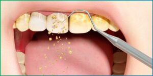 What Makes Dubai’s Teeth Cleaning Technology Stand Out?