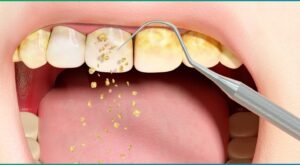 What Makes Dubai’s Teeth Cleaning Technology Stand Out?