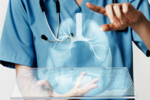 Early Consultation with a Lung Cancer Specialist Can Save Lives