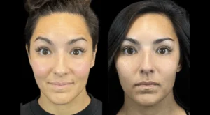 Why Choosing the Best Plastic Surgeon in Dubai Matters for Safe Botox Treatments