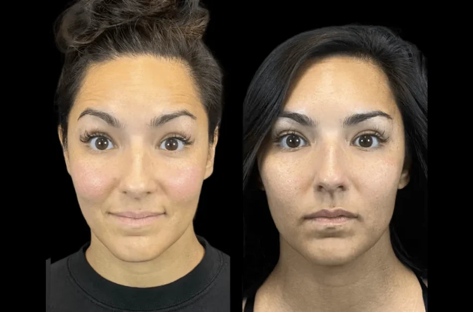 Best Aesthetic Clinic in Dubai for Customized Anti-Aging Solutions