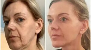 Best Aesthetic Clinics in dubai