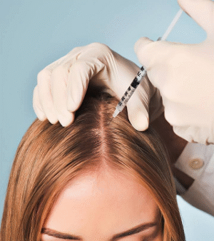 PRP Hair Treatment in Dubai: Enhance Your Hair Transplant Results