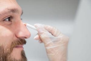 What Is Rhinoplasty and Who Should Consider It?