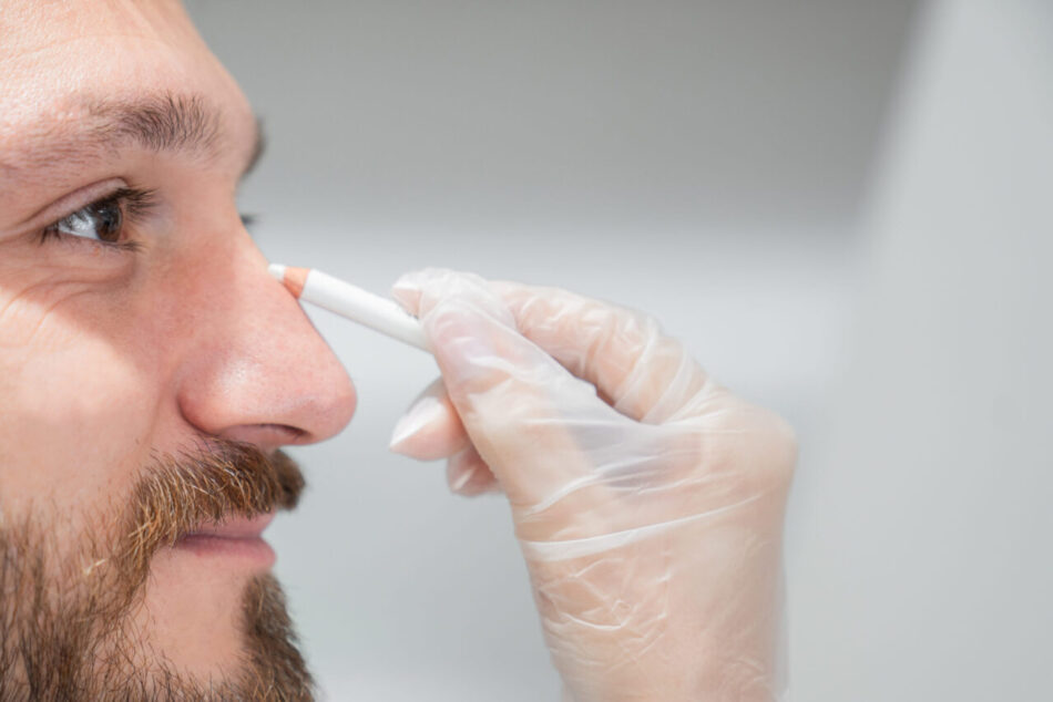 What Is Rhinoplasty and Who Should Consider It?