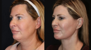 Skin Tightening in Dubai: What Makes These Clinics Stand Out for Results?