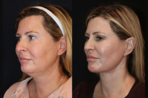 Skin Tightening in Dubai: What Makes These Clinics Stand Out for Results?