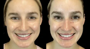 Why the Best Aesthetic Clinic in Dubai Is the Go-To for Skin Rejuvenation