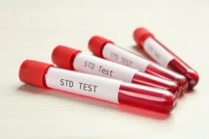 Comprehensive Guide to Booking an STD Test in Dubai for Better Sexual Health