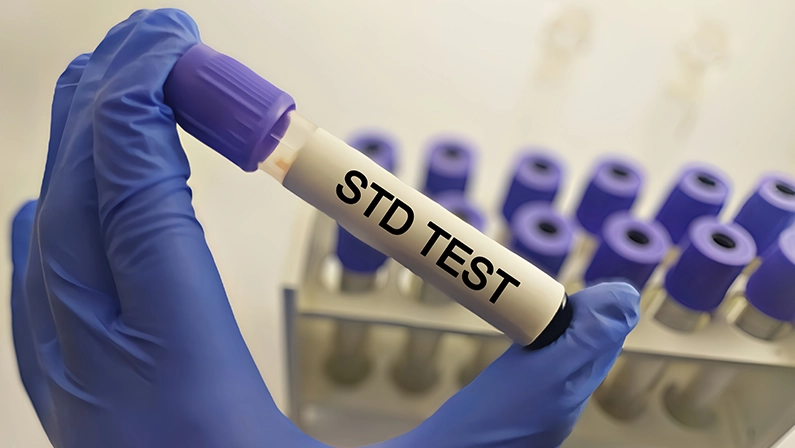 How to Prepare for an STD Test