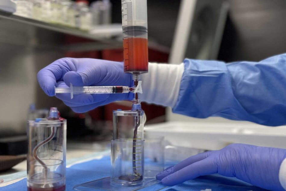 Stem Cell Therapy Explained for Beginners