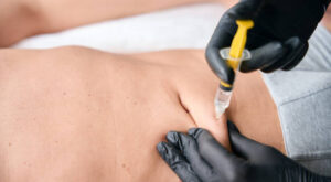 حقن إذابة الدهون: طريق سريع لنحت الجسم