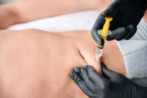 حقن إذابة الدهون: طريق سريع لنحت الجسم