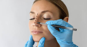 كيف تختار أفضل طريقة لعملية تجميل الأنف بطريقة آمنة وفعالة